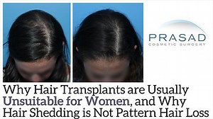 Importance of Differentiating Female Pattern Hair Loss from Telogen Effluvium, and Caution with Transplants