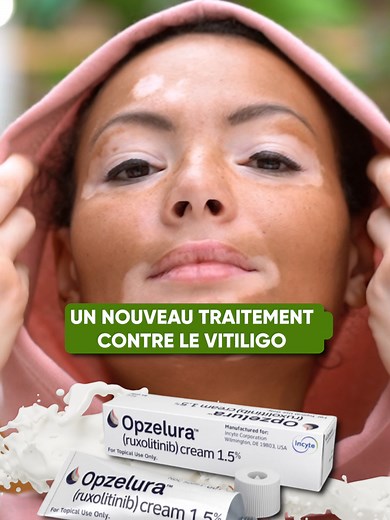 L'Opzelura : Un nouveau traitement contre le Vitiligo