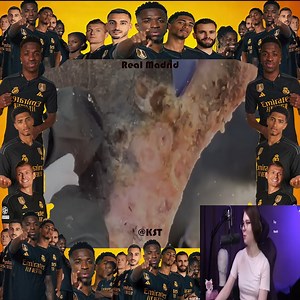 Reach to rescue little legs & Toenails from jigger digging removal 😭😭💔💔 #fypシ゚ #rescue #rescuedog #rescue #botfly #mangoworm #dog #doglover | Dr. Vinord Gambia