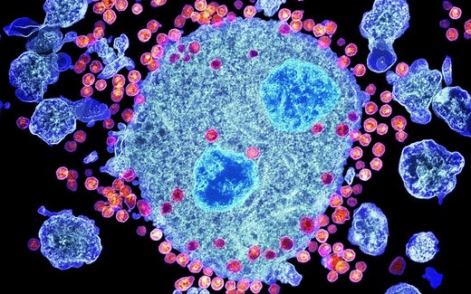 【3D微生物】：人类免疫缺陷病毒（HIV）是如何攻击人体的？
