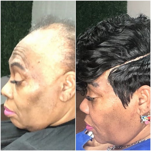 Woman with Alopecia gets the most amazing hair transformation! | MetDaan Makeup