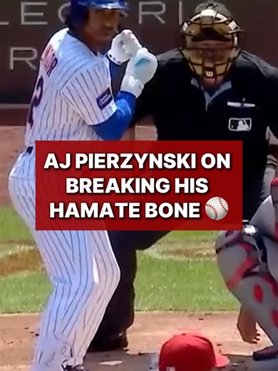 Understanding Hamate Bone Injury and Recovery