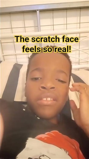 The scratch face is so real!