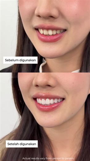 Discover USmile Fresh White Toothpaste for Bright Smiles