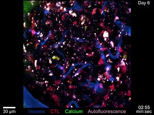 Microglia help T cells in the brain target invasive respiratory viruses without harming the central nervous system's precious supply of neurons, found scientists from NINDS Brain for Life: https://fcld.ly/s0u1qi1 | Science Immunology