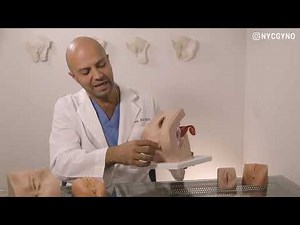 What is Vaginoplasty?