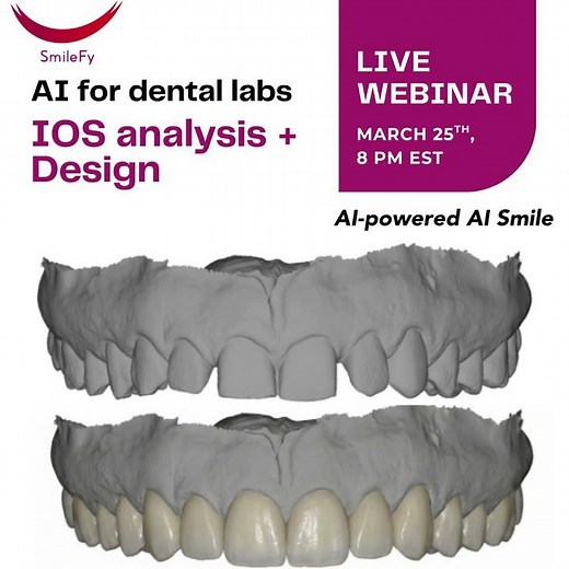 AI for dental labs: AI smile analysis and design