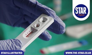 NASCOP, HENNET warn against faith-healing claims on HIV patients