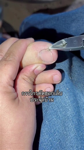 กรรไกรตัดเล็บขบ: วิธีการเลือกใช้อย่างมีประสิทธิภาพ