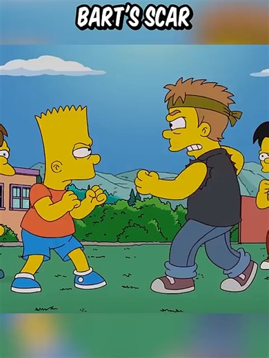 Exploring Bart Simpson's Iconic Hand Scar in The Simpsons
