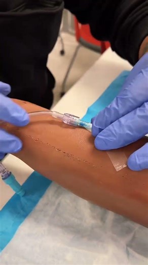 Do This Wrong And Your Vein Blows...