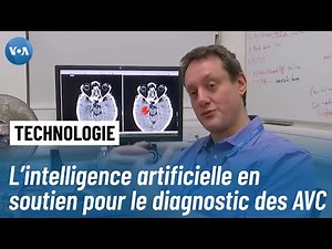Un logiciel d'IA double la précision du diagnostic des AVC
