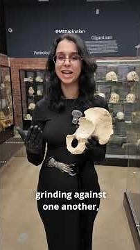 Exploring pelvic eburnation