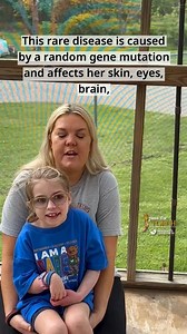 Join SWF Torchbearer family, the Brewbakers, for The SWF Giving Day on May 25th (or any day) by giving a gift of hope in honor of children like Celine. 💜 Pass the Torch! 🔥 Donate at www.Sturge-Weber.org/donate-today 👍 Like this post 🔄 Share it with your friends 💬 Leave a supportive comment Help us light the way for future generations and make a real difference in the lives of families affected by this rare disease. 📸 Thank you, @deborah.brewbaker, Celine (Rare Warrior), Harrison, and Kevin