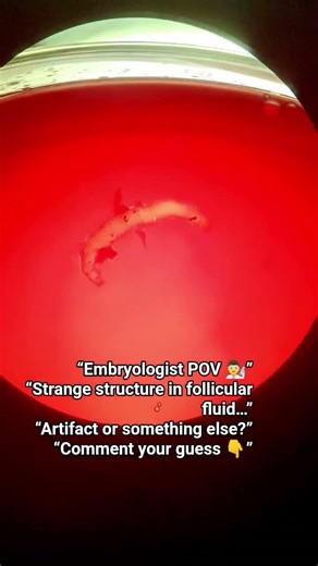 “Found THIS in follicular fluid during OPU… 😳”“Any idea what this could be?”