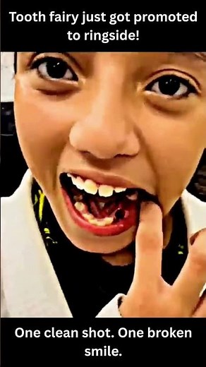 He Lost a Tooth in a Karate Match 😬 | Funny Karate Meme