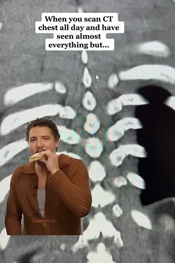 CT Chest Scan: Understanding the Process