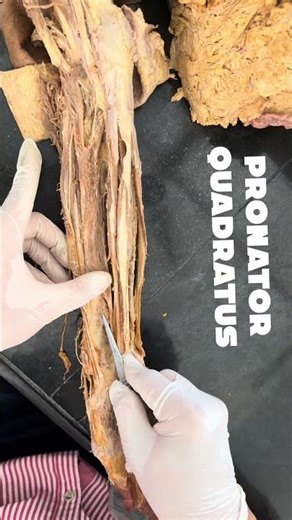 #mbbs #medical #medicalstudent #anatomy #medico #dissection #learning #science #biology #education