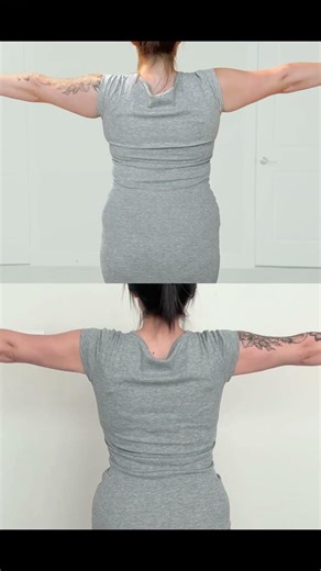 Nicolette's AirSculpt 3 Month Results