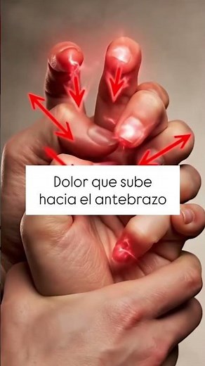 ¿Dolor y hormigueo en las manos?