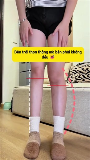 Miếng Lót Vòm Chân Nâng Chiều Cao Giúp Chân Thẳng Dài