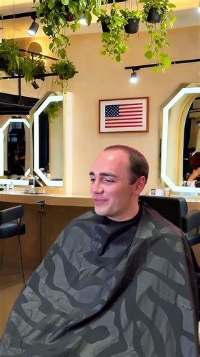 Effective Hair Replacement Solutions for Bald Heads