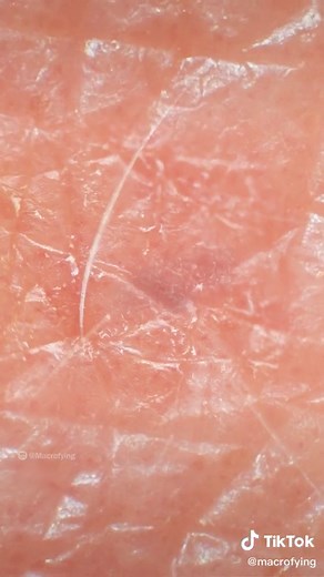 #macro #microscope #zoom #viral #macrozoom #hand #science #biology | pimple under microscope