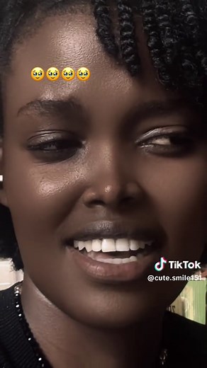 Discover Adorable Smiles in New Trend