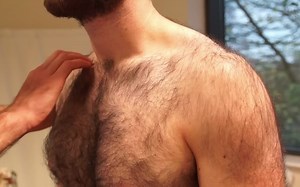 肩部检查 Shoulder Examination OSCE