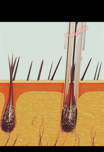 Transplante Capilar: Técnicas e Cuidados Essenciais