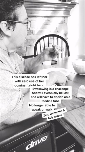 Understanding Corticobasal Degeneration: A Caregiver's Guide