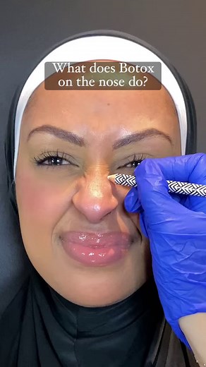 9.1K views · 22 reactions | Lift, smooth, and define your nose with...