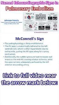 Named Echocardiographic Signs in Pulmonary Embolism