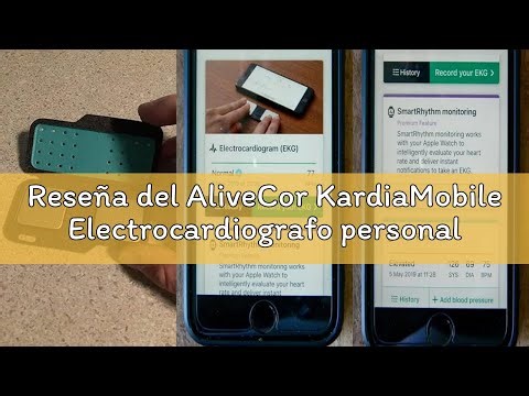 Reseña del AliveCor KardiaMobile Electrocardiografo personal de 1 derivación - Registre ECG en casa