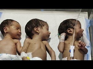 Triplets’ 3rd Day in NICU — Tiny Fighters Growing Strong 💕👶👶👶"