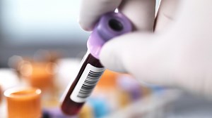 Breakthrough for Rhythm’s next-gen bowel test