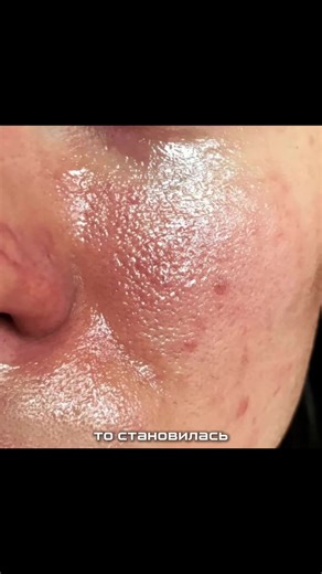 Discover the Benefits of B:Lab Skin Balance Duo