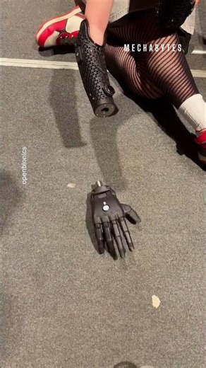 From Sci-Fi to Reality! 🦾 The Hero Arm is a Game Changer! ✨
