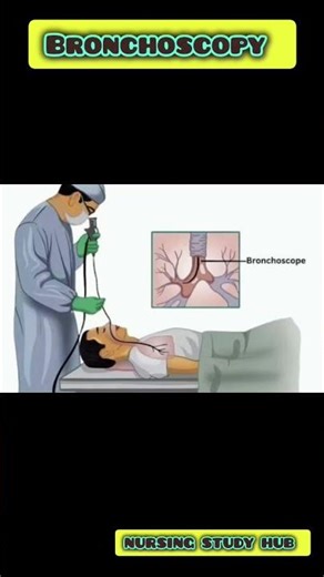 Bronchoscopy #shortsfeed #ytshortsindia #viralvideos