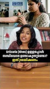 Urticaria (Hives) ഉള്ളപ്പോൾ സന്ധിവേദന ഉണ്ടാകുന്നുണ്ടോ? | Urticaria & Joint Pain #arthritis