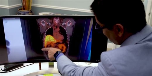 Medical Minute: How Pluvicto targets metastatic prostate cancer that has failed multiple therapies