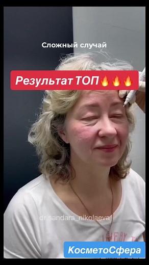 Hair Care Procedures: Close-Up Insights and Tips