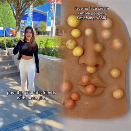 Watch relax and clear your mind a bit #pimplepopperaddict #pimple #extractions #ingrownhairremoval #ingrown #ingrownhair #picking #tweezers #skinpicking #satisfying #blemishes #blemishbandits #cloggedpores #pores #acne #hair #cleanskincare #skincareroutine #fyp #relaxingvideos #viral #trending #viraltiktok #creatorsearchinsights