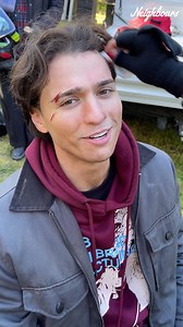 It's been a week of special effects, so let's take a bow to our incredible makeup team... | Neighbours