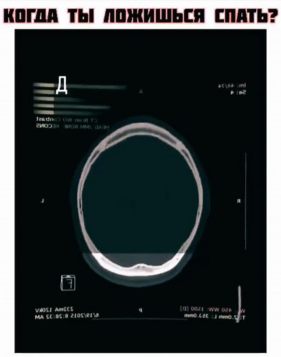 Understanding Medical Imaging: A Look at Head Scans