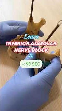 Learn Inferior Alveolar Nerve block in less than 90 seconds !