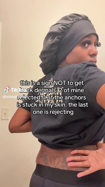 Back Dermal Piercings: Risks, Scars, and Removal