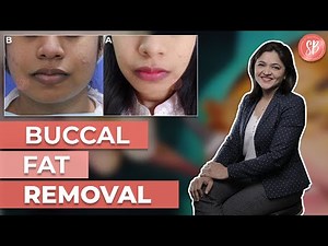 Buccal Fat Removal Surgery, Recovery & Results | Face or Cheek Fat Removal | Dr. Shilpi Bhadani