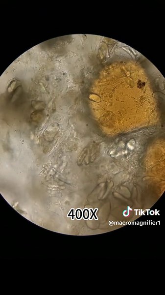 Exploring Sewer Water Under a Microscope