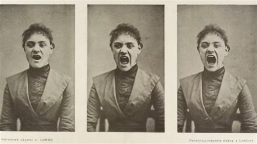 These doctors invented a diagnosis to control women